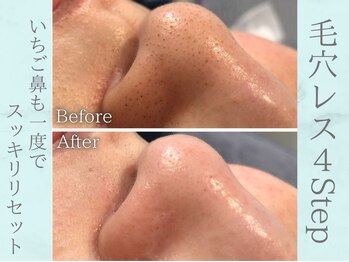 ネオファースト(NeoFirst)の写真/HPB・Google口コミ高評価☆通うたびに“素肌が好きになる”フェイシャル専門サロン【外苑前駅すぐ】