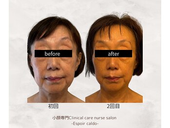 エスポワールカルド(Espoir caldo)/