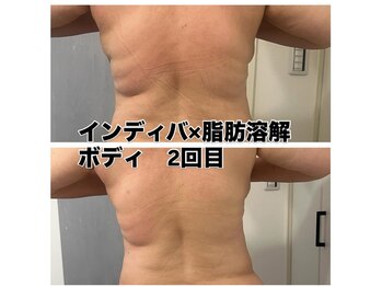 美温(mion)/レッドショット×ボディ