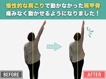 岡山整体 リソル(Resol)/施術 Before→After