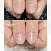 エオック(EOQC)