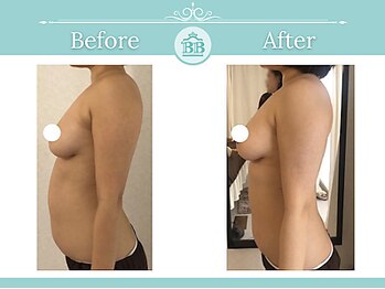 美人バスト 辻堂店/バストを残してダイエット