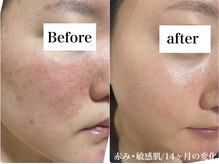 コマ(KOMA)の雰囲気(首肩こり、猫背などのお悩みにも◎)