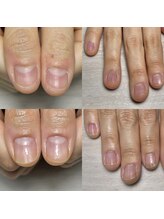 ロイ(LOI)/自爪育成コース