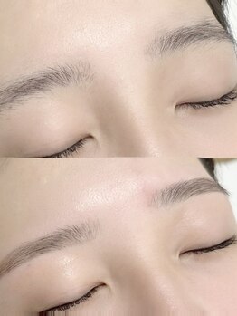 エヌ(N)の写真/美眉アイブロウWAX+フェイシャルWAX☆毛穴の汚れや古い角質をしっかり落とす!お顔の印象もUP◎