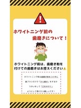 ホワイトニングショップ 豊田店(WHITENING SHOP)/注意事項