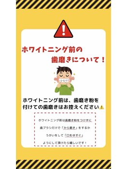 ホワイトニングショップ 豊田店(WHITENING SHOP)/注意事項