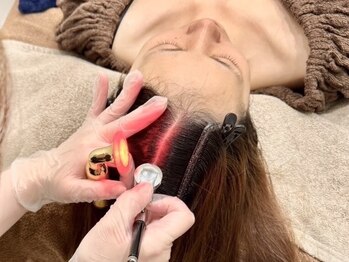 トータルビューティー ソラン(Soran)の写真/最先端美容“キュライム”導入★本気で悩む方こそへ受けてほしい、結果に繋がる育毛促進ケアで感動を！