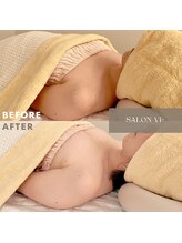 サロン ヴィプラス(SALON Vi+)/初回バストケアのBeforeAfter