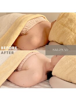 サロン ヴィプラス(SALON Vi+)/初回バストケアのBeforeAfter