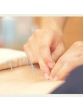 やぎ鍼灸接骨院/鍼灸施術