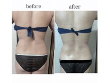 カピリナ(Kapilina)/ WINBACK90 1回【30代女性】