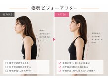 ベアフット(BARE FOOT)/私生活で首3cm損してる