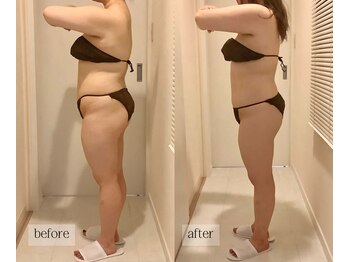 シエル(ciel)/before→after