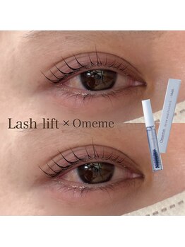 リボーンビューティーリゾート(re-born Beauty Resort)/Omeme