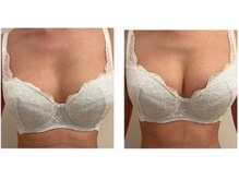 エスビューティー 三軒茶屋(S beauty)/バストケア・三軒茶屋・痩身