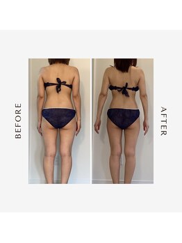 ラグレ(LUXRE)/次世代EMS効果（30代）