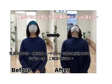すまいむ整体院/首、肩の症状