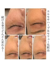 ルーナ ジェーナ(Luna llena)/シミ・小じわへアプローチ！