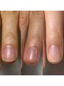 【自爪育成】初回カウンセリング30分