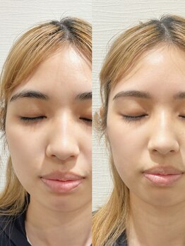 アイブロウメニューがあるサロン