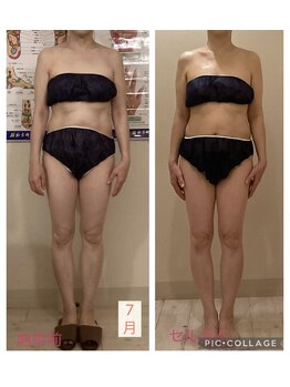 小顔コルギ専門店 フェルーシュ 成田駅前店(Feruche)/50代女性 結果写真