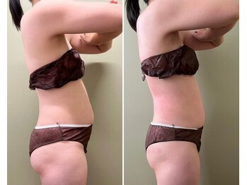 モモリラ(momorila)/セルクラ