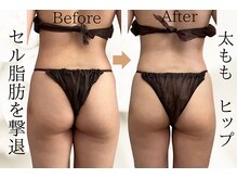 タノソイネ(tanosoine)の雰囲気（ハイパーナイフ痩身リンパ【リンパ/小顔/たるみ/痩身/むくみ】）