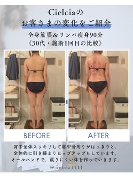 シェルシア(Cielcia)の写真/浮腫み・脂肪・歪みに徹底アプローチ〇太ももの張りや四角いお尻にコンタクト！あっとゆうまに元に戻します