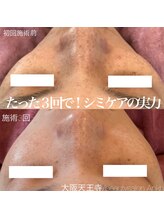 アンク(Ankh)/たったの3回でこの結果