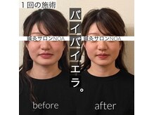 ノア(NOA)