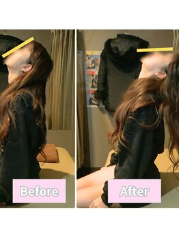 ナオル整体 仙台院(NAORU整体)/20 代 肩こり 反り腰 腰痛