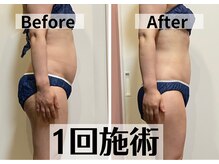 エッセンス(ESSENCE)の雰囲気（☆ENGボディメンテナンス☆驚きの結果です。コリも解消！）