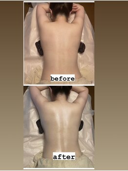 イヴ(Yves)/ハイパーナイフbefore/after