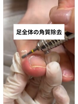 足のトラブルをご相談ください！