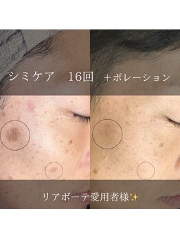 ニコ ウィズ(Nico with)/【メンズ】シミケア