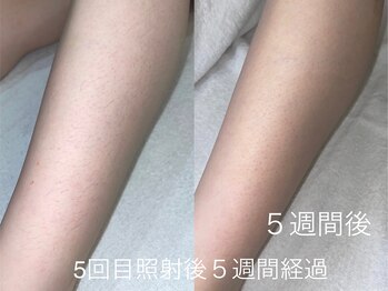 なちゅらる 苫小牧/