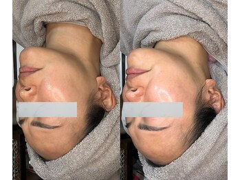 マザートウキョウ(Mother TOKYO)/ララピールでツヤ肌に*