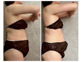 ココア(CoCoa)/活性リンパ洗浄