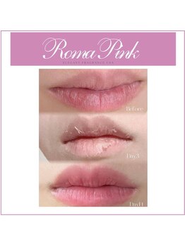 リリーガーデン 手稲店(Lily Garden)/ローマピンク【手稲/札幌】