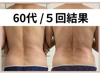 リストアミー(Restore me)/