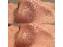 プライベートサロン ルクサージュ(Luxeage)/肌ケア専用の時短メニューも有り