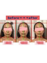 小顔整体研究所 KSラボ 新潟中山店/