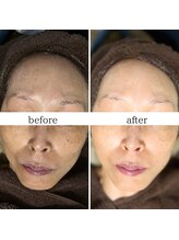 マーギアー(Magier)/ハーブ＋ダーマ　初来店→４回目