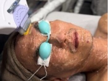 モミン(MOMI.N)の写真/【男性OK】《脱毛難民からの脱出！この夏は”WAX”×”光脱毛”で卒業》全身から部位ごとまで幅広く対応◎