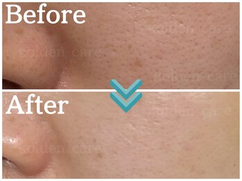 ゴールデンケア 岡崎店(Golden Care)/整体・毛穴洗浄・フェイシャル