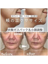 太陽と月/フェイシャル人気No.1★