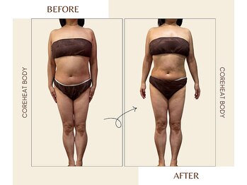 セレナ(Serena)/コアヒートボディBefore/After