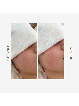 オーシャン(OCEAN)/ムートン&ヘッドスパ