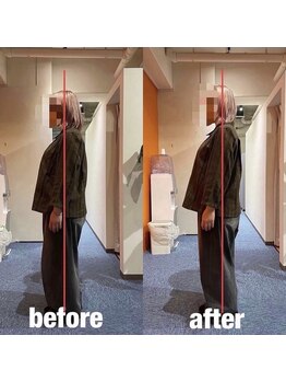 カワル整体 上通り院/猫背が改善しない。